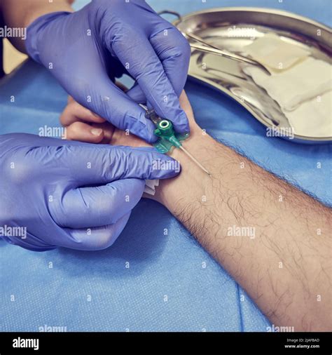 Intravenous Catheter In The Hands Of A Doctor Preparation For Vein