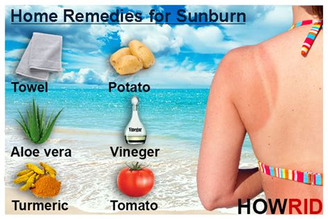 How To Get Rid Of Sunburn Fast