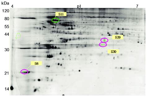 Identification Of Differential Protein Expression In Myopia Early