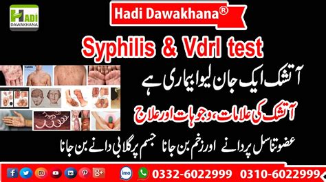 Atshik Ki Alamat Or Ilaj Atshik Stage Ka Ilaj Syphilis