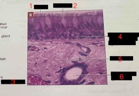 A P Ii Nasal Mucosa With Goblet Cells Histology Labeling Flashcards