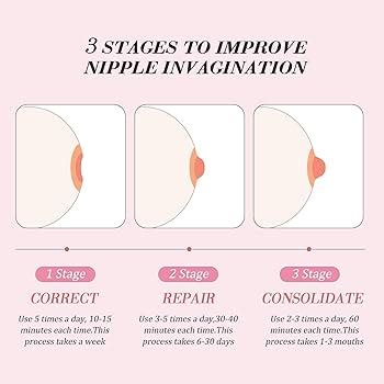 Nipple Retraction Causes Treatment Picture And More 54 OFF