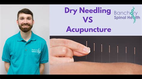 Dry Needling Vs Acupuncture Youtube