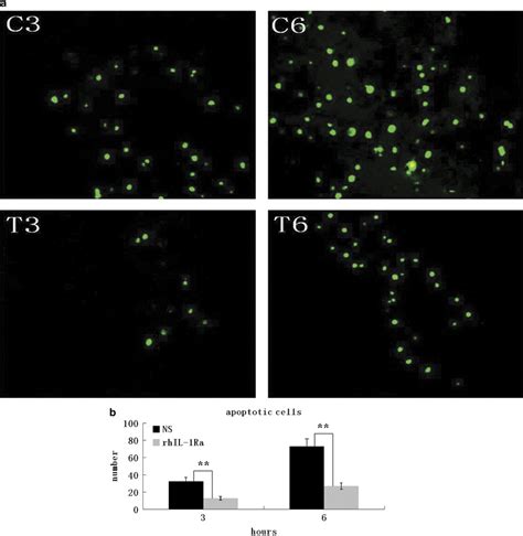 RhIL 1Ra Reduces Hepatocellular Apoptosis In Mice With Acetaminophen