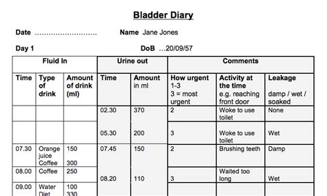 Urine Void Chart