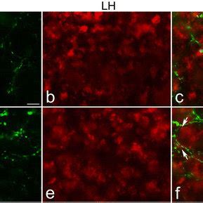 Double Immunofluorescence Photomicrographs Of Transverse Sections