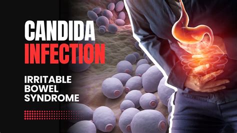 What Is Candida Gut Infection Explained Youtube