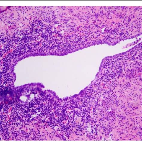 Histopathological Findings Hematoxylin Eosin Hande Staining 100× A Download Scientific