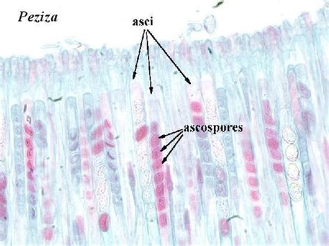 Peziza Under Microscope Labeled