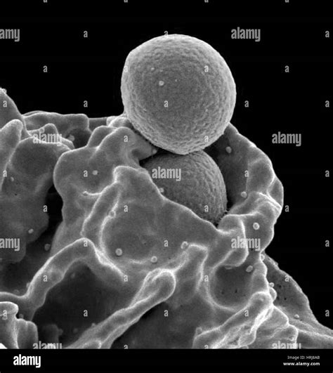 Scanning Electron Micrograph Mrsa Bacteria Hi Res Stock Photography And