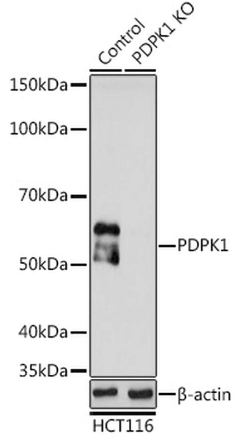 Pdpk1 Polyclonal Antibody Pa5 120471