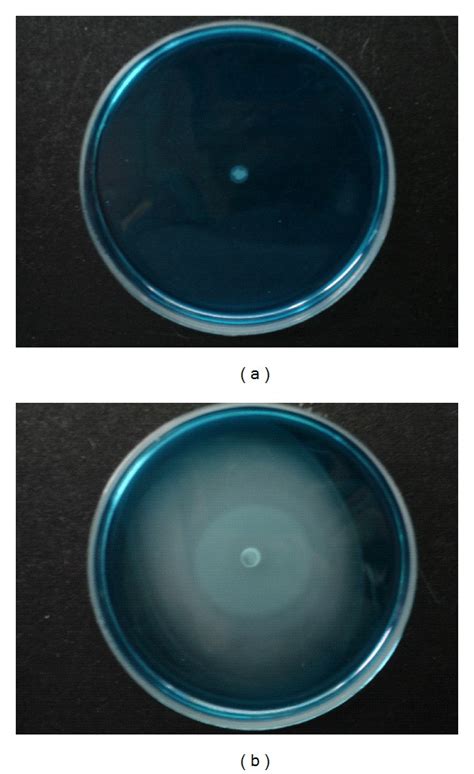 Salmonella Enterica Subsp Enterica Serovar Typhimurium Lb 5010 And The