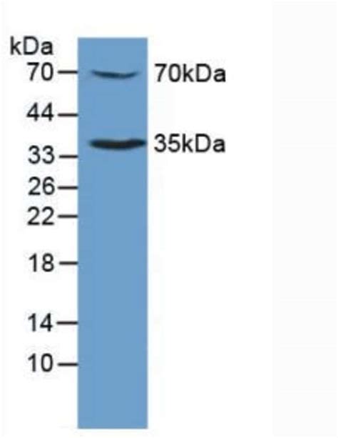 c Mpl Polyclonal Antibody Invitrogen 20 μL Unconjugated Fisher