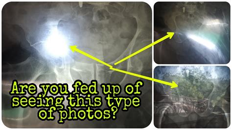 How To Take Photo Of Radiograph At Home Youtube