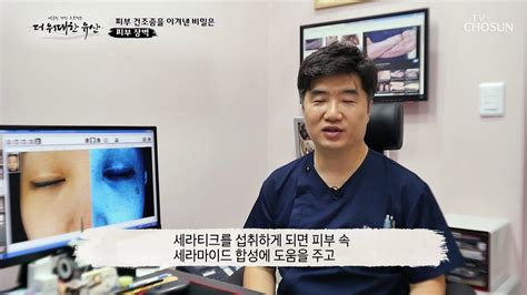 《세라티크》 건강하고 탄력 있는 피부를 위한 특급 비책 Tv Chosun 20221103 방송 동영상 Dailymotion