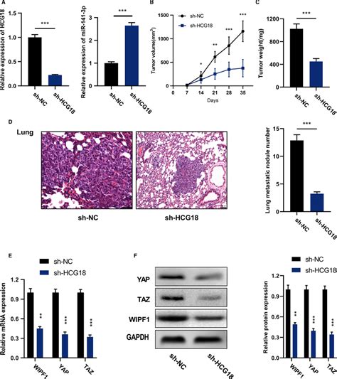 Inhibiting Hcg Suppresses The Growth And Mts Of Tumor In Vivo A