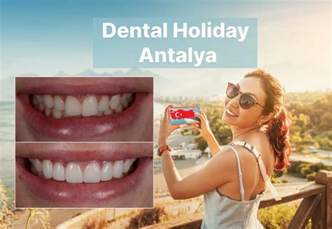 Dental Holiday Antalya Dental Tourism Findglob