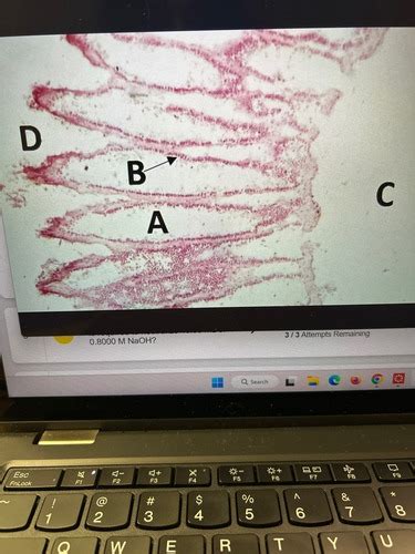 Bio 111 Body Lab Flashcards Quizlet