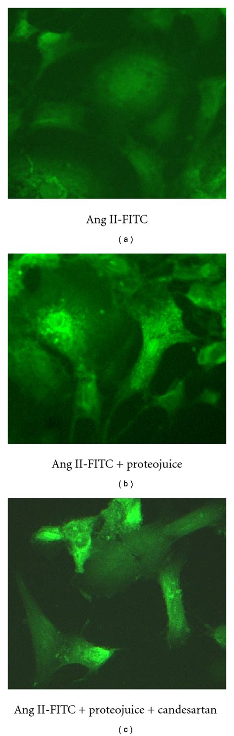 Transfection Of Human Mesangial Cells With Ang II Using Proteojuice