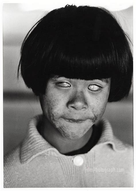 Blind girl by Christer Strömholm - FilmPhotograph.com