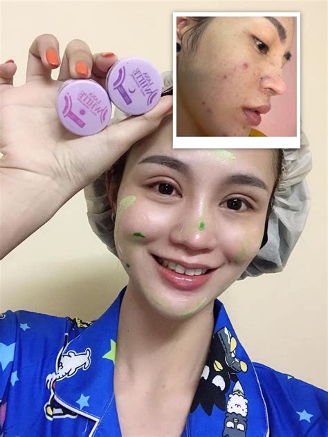 ครีม LANA... - ครีม LANA White - ลาน่าไวท์ ราชบุรี By :Ben