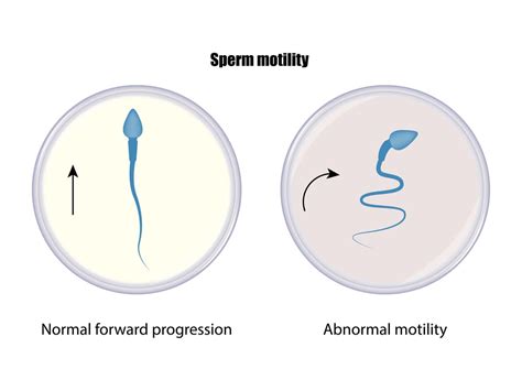 Going swimmingly: Sperm breakthrough offers new fertility hope – Monash ... 