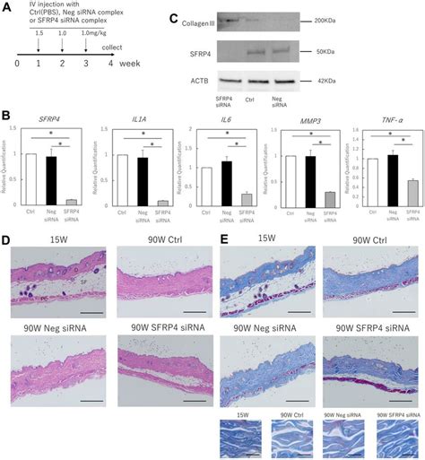 Effects Of SFRP4 Knockdown On The Skin Of Aging Mice A Time Course