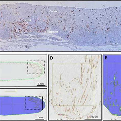 Quantification Of Cd31 Positive Vessel Area In Human Ovarian