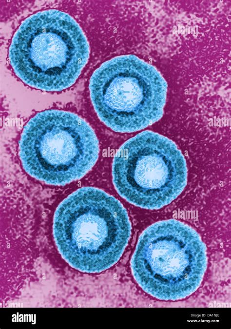 VARICELLA ZOSTER VIRUS Stock Photo Alamy