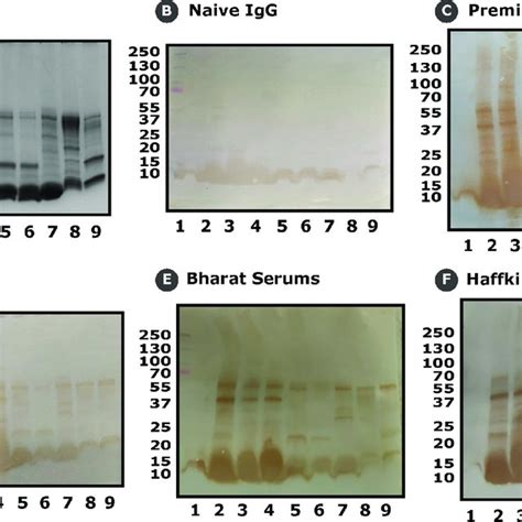 Principles Of Optical Immunoassay For Snake Venom Detection A The