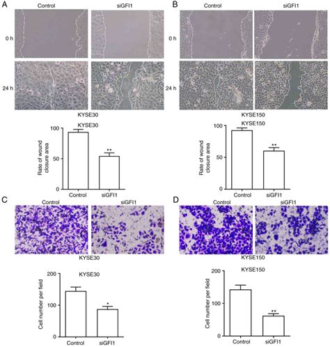 GFI1 Promotes The Proliferation And Migration Of Esophageal Squamous