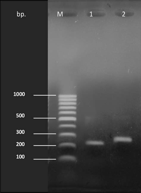 Analysis Of Dig Labeled Probe By Electrophoresis On A Agarose Gel