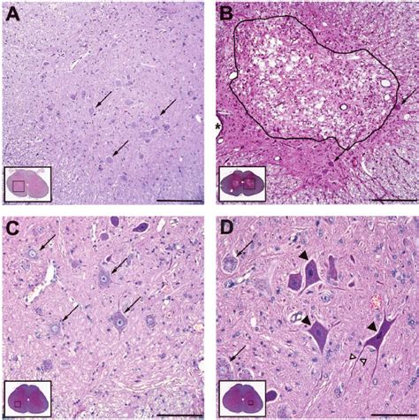 Representative Photomicrographs Of Spinal Cord Segments At L L All