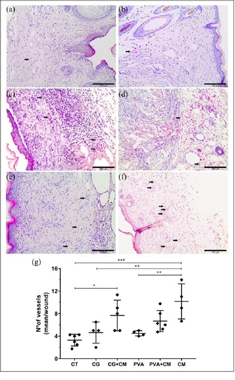 PDF The Skin Regeneration Potential Of A Pro Angiogenic Secretome