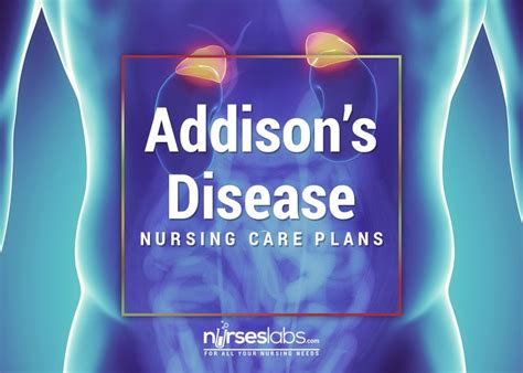 4 Addison S Disease Nursing Care Plans Nursing Care Plan Addison S Disease Nursing Nursing Care