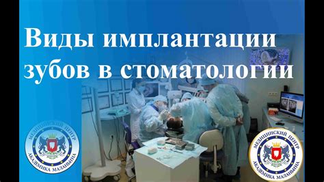 Виды имплантации зубов в стоматологии. Подробно о всех видах и этапах ...