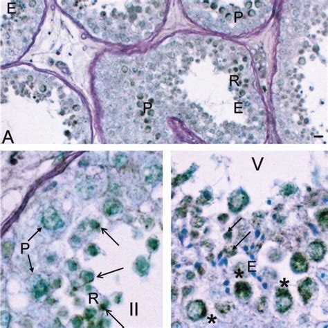 Expression Pattern Of Sptrx 3 Protein In Human Testis Human Testicular Download Scientific