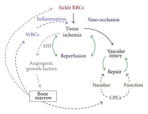 Diagram Of Cpc And Wbc Mobilization By Vaso Occlusion Induced Tissue