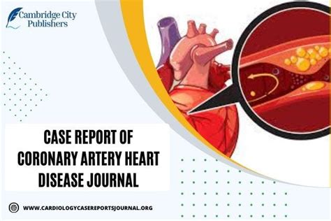 Case Report Of Coronary Artery Heart Disease Journal By Cambridge