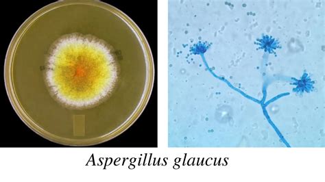 Aspergillus Morphology Clinical Features And Lab Diagnosis • Microbe Online