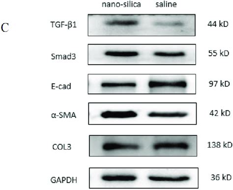 The Expression Of Tgf β1 Smad3 E Cad α Sma And Col3 In Pulmonary