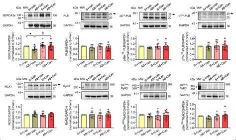 Western Blot Analysis Of Ca 2 Handling Proteins Expression In Left