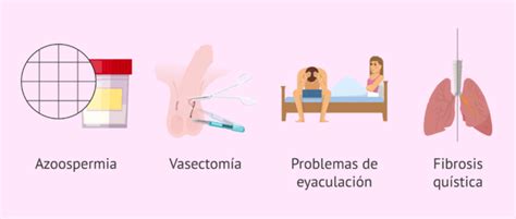 C Mo Es La Biopsia Testicular Para Extraer Espermatozoides