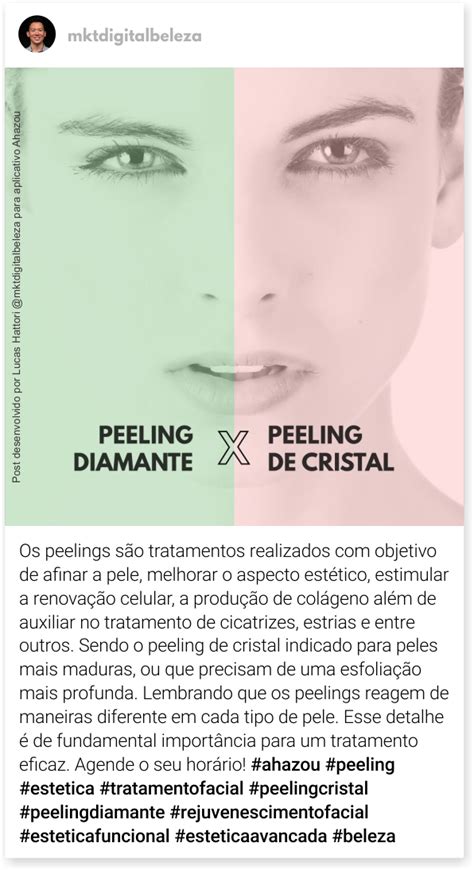 Os peelings são tratamentos realizados objetivo de afinar a pele