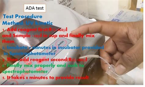 Ada Test Introduction Clinical Significance Procedure And Normal Range