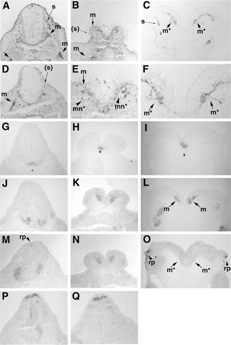 Cranial Nerve Development Semantic Scholar