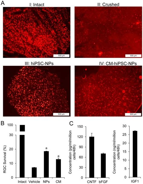 Retrograde Labeling By Intracollicular Injection Of Dii Showed Labeled