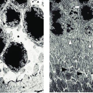 Electron Micrographs Showing The Outer Segments OS And Inner Segments