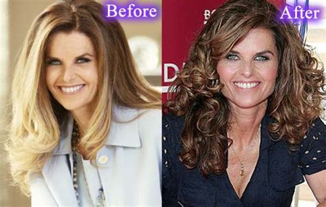 Maria Shriver Plastic Surgery Before And After Photos - CelebLens.Com