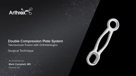 Arthrex Double Compression Plate System Talonavicular Fusion With